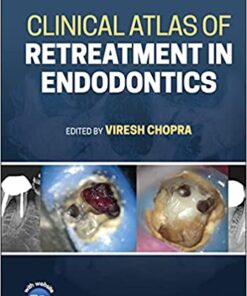 Clinical Atlas of Retreatment in Endodontics 1st Edition PDF