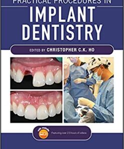 Practical Procedures in Implant Dentistry 1st Edition PDF