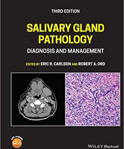 Salivary Gland Pathology: Diagnosis and Management 3rd Edition PDF