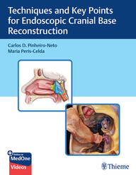 Techniques and Key Points for Endoscopic Cranial Base Reconstruction 1st Edition PDF & VIDEO