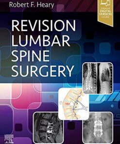 Revision Lumbar Spine Surgery E-Book 1st Edition PDF