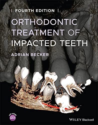 Orthodontic Treatment of Impacted Teeth 4th Edition PDF