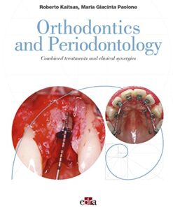 Orthodontics and Periodontology: Combined treatments and clinical synergies PDF