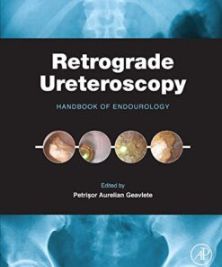 Retrograde Ureteroscopy: Handbook of Endourology 1st Edition PDF Original
