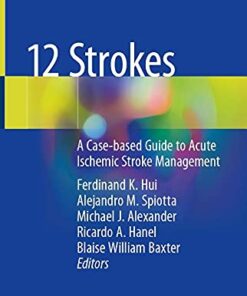 12 Strokes: A Case-based Guide to Acute Ischemic Stroke Management 1st ed. 2021 Edition PDF Original