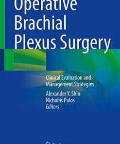 Operative Brachial Plexus Surgery: Clinical Evaluation and Management Strategies 1st ed. 2021 Edition PDF Original