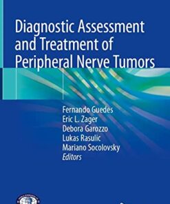 Diagnostic Assessment and Treatment of Peripheral Nerve Tumors 1st ed. 2021 Edition PDF Original