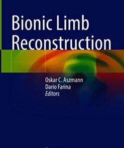 Bionic Limb Reconstruction 1st ed. 2021 Edition PDF Original