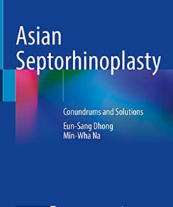 Asian Septorhinoplasty: Conundrums and Solutions 1st ed. 2021 Edition PDF Original