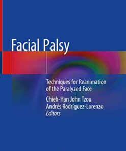 Facial Palsy: Techniques for Reanimation of the Paralyzed Face 1st ed. 2021 Edition PDF Original
