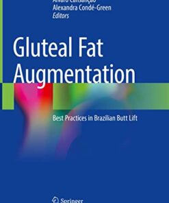 Gluteal Fat Augmentation: Best Practices in Brazilian Butt Lift 1st ed. 2021 Edition PDF Original