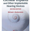 Cochlear Implants and Other Implantable Hearing Devices, 2nd Edition (Original PDF from Publisher)