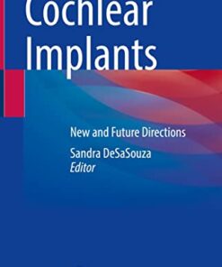 Cochlear Implants: New and Future Directions 1st ed. 2022 Edition PDF Original