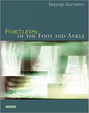 Fractures of the Foot and Ankle (Original PDF From Publisher)