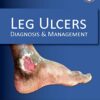Leg Ulcers: Diagnosis and Management (Original PDF from Publisher)