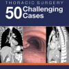 Thoracic Surgery: 50 Challenging cases (Original PDF from Publisher)