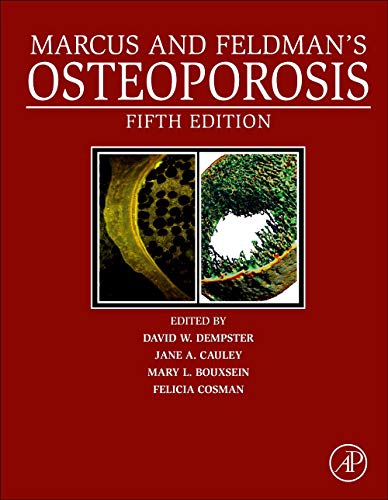 Marcus and Feldman’s Osteoporosis, 2 Volume Set, 5th Edition (True PDF From Publisher)Marcus and Feldman’s Osteoporosis, 2 Volume Set, 5th Edition (True PDF From Publisher)