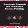 Endoscopic Diagnosis and Treatment in Prostate Pathology Handbook of Endourology