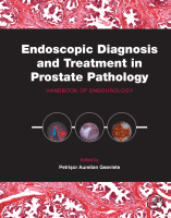 Endoscopic Diagnosis and Treatment in Prostate Pathology Handbook of Endourology