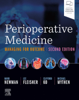 Perioperative Medicine Managing for Outcome