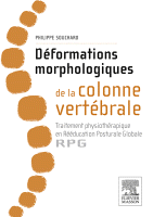 Déformations morphologiques de la colonne vertébrale Traitement Physiothérapique en Rééducation Posturale Globale-Rpg