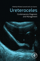 Ureteroceles Contemporary Diagnosis and Management