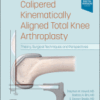 Calipered Kinematically Aligned Total Knee Arthroplasty Theory, Surgical Techniques and Perspectives