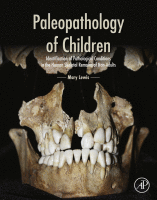 Paleopathology of Children Identification of Pathological Conditions in the Human Skeletal Remains of Non-Adults