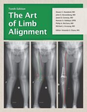 The Art of Limb Alignment, Tenth Edition