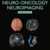 Handbook of Neuro-Oncology Neuroimaging, 3rd Edition (Original PDF