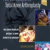 In 1990, Dr. Kenneth Krackow wrote The Technique of Total Knee Arthroplasty to teach the basics of TKA for end-stage arthritis—everything from nonsurgical to surgical intervention and postoperative rehabilitation.