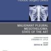 Malignant Pleural Mesothelioma, An Issue of Thoracic Surgery Clinics (Volume 30-4) (The Clinics: Surgery, Volume 30-4) (Original PDF