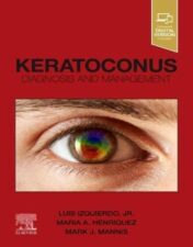 Keratoconus: Diagnosis and Management (Original PDF