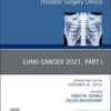 Lung Cancer 2021, Part 1, An Issue of Thoracic Surgery Clinics (Volume 31-3) (The Clinics: Surgery, Volume 31-3) 2021 Original PDF
