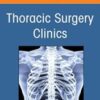 Global Thoracic Surgery, An Issue of Thoracic Surgery Clinics (Volume 32-3) (The Clinics: Internal Medicine, Volume 32-3) 2022 Original PDF