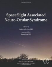 Spaceflight Associated Neuro-Ocular Syndrome (Original PDF