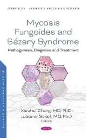 mycosis-fungoides-causes-diagnosis-and-treatment-