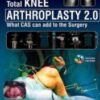 Total Knee Arthroplasty 2.0: What CAS can add to the Surgery 1st Ed