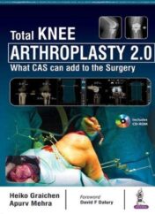 Total Knee Arthroplasty 2.0: What CAS can add to the Surgery 1st Ed