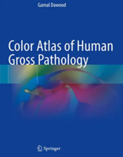 Color Atlas of Human Gross Pathology 2022 Original PDF