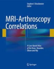 MRI-Arthroscopy Correlations A Case-Based Atlas of the Knee, Shoulder, Elbow, Hip and Ankl 2022 Original pdf