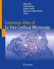 Cutaneous Atlas of Ex Vivo Confocal Microscopy 2022 Original pdf