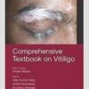 Comprehensive Textbook on Vitiligo 2022 Original pdf