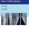 Complex Primary Total Knee Arthroplasty (Original PDF