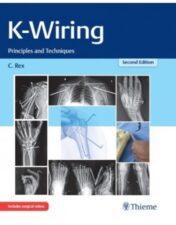 Overwhelming response to the first edition and compelling needs of the practicing orthopedic surgeon and the plastic, hand, and microvascular surgeon have seeded the way for the second edition of K-Wiring: Principles and Techniques